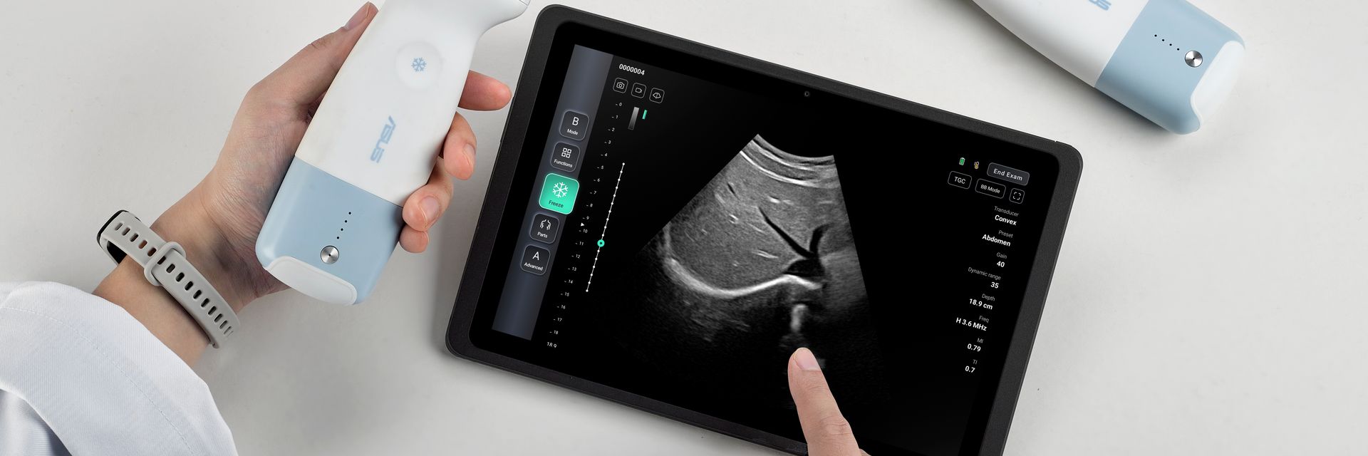 AI-assisted Ultrasound Solutions Show the Path to Better, Smarter Care