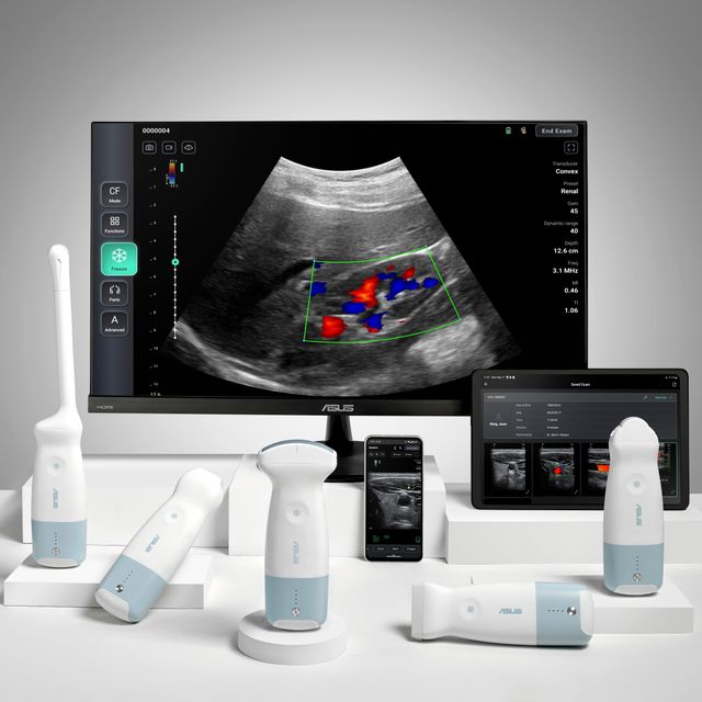 ASUS Handheld Ultrasound Solution LU800